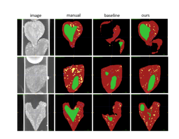 Neural Network Segmentation of Cell Ultrastructure Using Incomplete Annotation